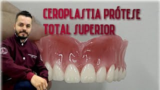 Ceroplastia de uma protese total superiorpasso a passo [upl. by Atinek]