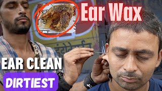 Dirtiest Ear Wax found During Ear Cleaning at Street Side Ear Cleaner  ASMR [upl. by Margaret]