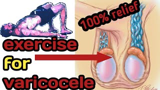 varicocele exercise  varicocele exercise treatment  yoga for varicocele  Hindi [upl. by Yrellav557]