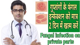 Fungal Infection in Private Parts  Fungal Infection treatment fungalinfectioninprivateparts [upl. by Sieber850]