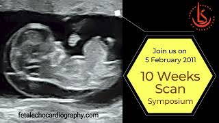 10 Weeks Scan Symposium 2022 [upl. by Marcelle]