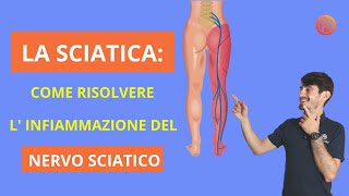 La SCIATICA Infiammazione del nervo sciatico Come trattarla 2022 [upl. by Cole]