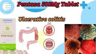 Pentasa 500Mg Tablet UseBenefitsSide EffectsUlcerative Colitis TreatmentFull Reviews [upl. by Aiuqal702]