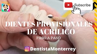 🤔 Cómo❓Hacer👅PROVISIONAL ANTERIOR Paso a Paso [upl. by Seeto696]