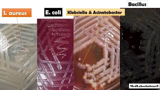 Most Common Bacterial Colony Morphology E coliKlebsiellaPseudomonasProteusStaphylococcusBaci [upl. by Lieno]