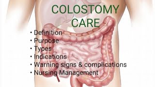 Colostomy Care  Types of Colostomy  Nursing Management [upl. by Muna989]