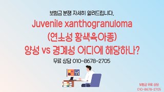 Juvenile xanthogranuloma연소성 황색육아종 양성 vs 경계성 어디에 해당하나 보험금 무료 상담 TEL 01086782705 [upl. by Tekcirc]