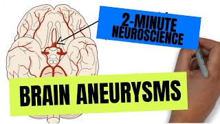 2Minute Neuroscience Brain Aneurysms [upl. by Siriso]