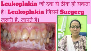 White Patch in mouthLeukoplakia amp its typesWhich Leukoplakia is dangerous amp transform to Cancer [upl. by Valenka]