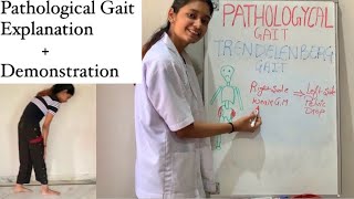 Pathological Gait  Exercise Therapy  Types Explained  physiotherapy [upl. by Euqinwahs770]