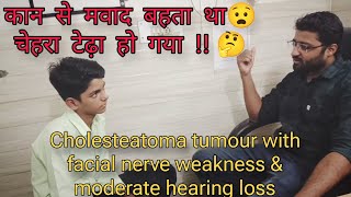 कान का बहना  चेहरा टेढ़ा होना  csom mastoiditis nerve palsy nerve grafting in pediatric patient [upl. by Dekeles]