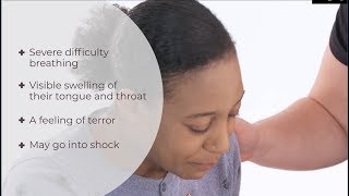 What is anaphylaxis  Anaphylactic shock  First Aid  iHASCO [upl. by Atalaya]