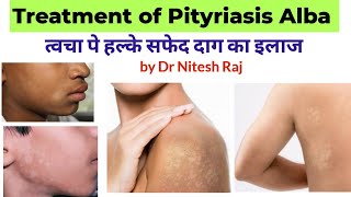 सफेद दाग का इलाजPityriasis Alba treatment in hindi drniteshraj [upl. by Rasure139]