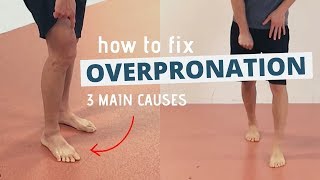 Pronated Feet and How to Fix 3 Different Causes of OVERPRONATION [upl. by Nonregla]