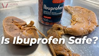 What Ibuprofen Does to the Body [upl. by Kcirdot]