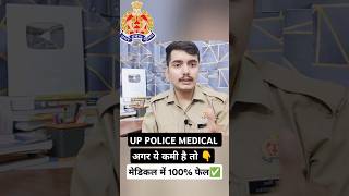 UP POLICE MEDICAL आपके अन्दर ये कमी है 😨 मेडिकल से बाहर 100✅ shorts uppolice [upl. by Ogirdor]