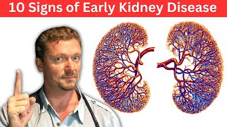 Tips to keep your kidney healthy  Dr Raghvendra Kashyap Hindi [upl. by Nicky712]