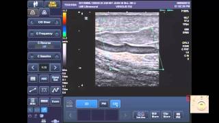 How to Use the Toshiba Viamo Ultrasound Machine [upl. by Chubb572]