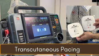 Crash Cart 04 Transcutaneous Pacing TCP [upl. by Lenrad]