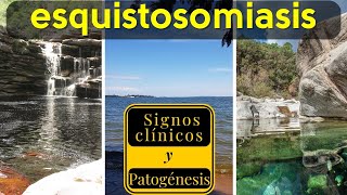 Schistosomiasis  Todo sobre una enfermedad milenaria que traspasa fronteras Esquistosomiasis [upl. by Lahey317]