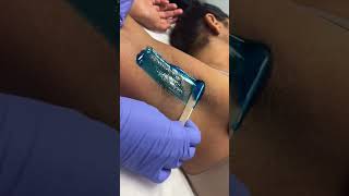 Quick professional underarm wax using hard blue wax from Starpil professional Esthetician [upl. by Gervais]