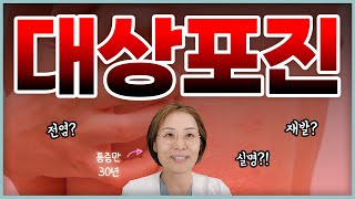 대상포진 환자들이 가장 많이 물어보는 7가지 [upl. by Coppinger981]