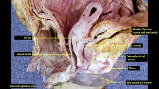 3Female pelvic organs 34 [upl. by Shelba343]