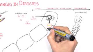 Diabetes Complication and Pathophysiology of the complication [upl. by Donal263]