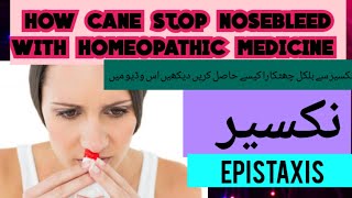 EpistaxisNosebleedcauses symptoms How can stop Epistaxis with homeopathic medicineDoctor Abida [upl. by Bovill]