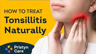 How to Treat Tonsillitis  Home remedies for Tonsillitis [upl. by Snej]