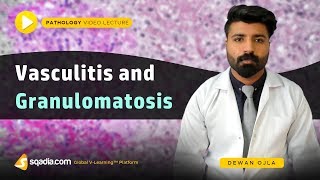 Vasculitis and Granulomatosis  Pathology Medical School  Education Made Easy  VLearning [upl. by Wendie377]