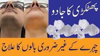 Face Hair Removal  How to remove hair from face  Face hair removal for women at home [upl. by Becker699]