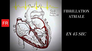 Arythmies animation cardiaque et ECG  Fibrillation Atriale Shorts [upl. by Nordek]