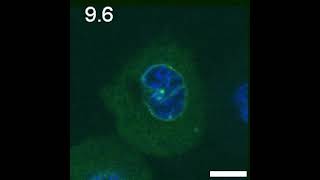 Microsphere injection from a cell cytoplasm into its nucleus with optical tweezers [upl. by Ignazio184]