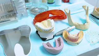 What does a prosthodontist do [upl. by Auhoj]