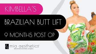 Kimbellas BBL  9 Month Post Op  Brazilian Butt Lift Before amp After By Dr Mehio At Mia Aesthetics [upl. by Topper]