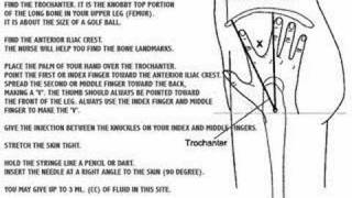 How to inject IM Selecting The Site For Injection [upl. by Yvaht455]