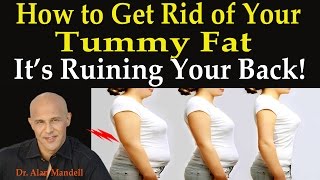 How to Get Rid of Your Tummy FatIts Ruining Your Back  Dr Mandell [upl. by Neva]