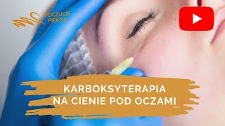 Karboksyterapia okolicy oczu  Poczucie Piękna [upl. by Anallese]