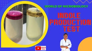 Indole Production Test Tamil Biochemical Test  IMViC Test  Identification of Bacteria [upl. by Adnamas]