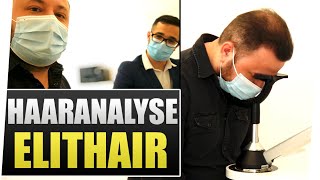 Haaranalyse für meine 2 Haartransplantation Türkei [upl. by Nojel807]