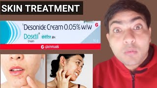 dosetil cream use in hindi [upl. by Glarum]