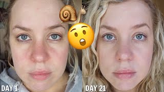 I Used SNAIL Skincare for 21 Days the results shocked me [upl. by Mcintosh826]