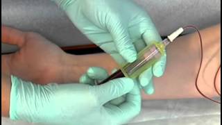 Sample Procedure  Venipuncture Butterfly Method [upl. by Nnail]