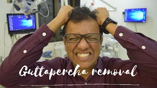 Guttapercha Removal  Easy technique to remove guttapercha in retreatment cases [upl. by Dlarej]