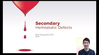 Secondary Hemostatic Disorders by PWarit [upl. by Payne]