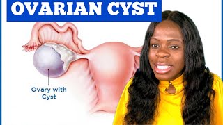 What is ovarian cystWhat are the types of ovarian cystDoes ovarian cyst affect getting pregnant [upl. by Nahsar]