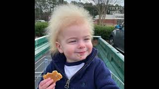 Boy With Rare Uncombable Hair Syndrome Brings a Smile to Faces [upl. by Rebba57]