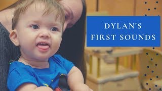 Dylans First Sounds  A Cochlear Implant Journey [upl. by Anahsak]