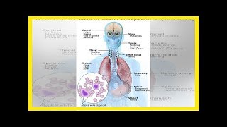 Haupthilfsmittel für Mononucleosis [upl. by Amaj]